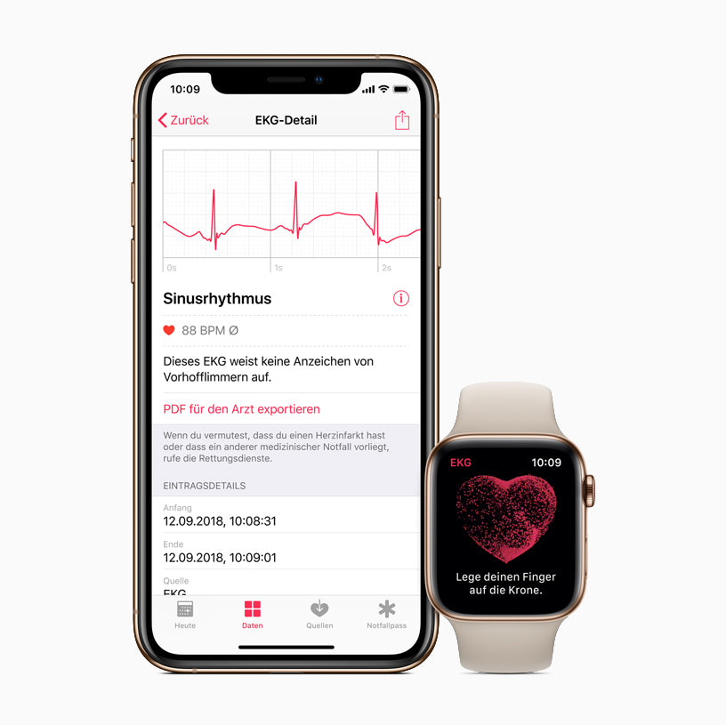 How to Take an ECG on the Apple Watch
