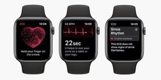 Apple watch band now with Kardia built in for realtime EKG