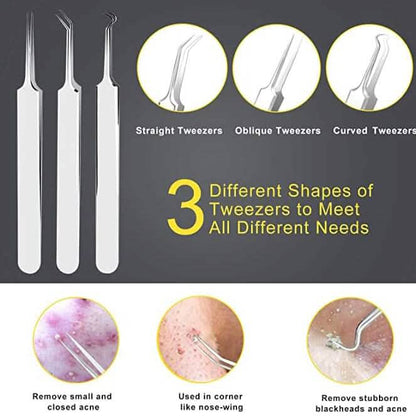 10-Piece: Blackhead Remover Tool DailySale