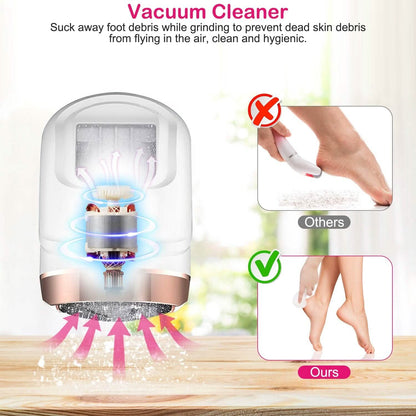 17-Pieces Set: Electric Foot Callus Remover with Vacuum Foot Grinder Rechargeable DailySale