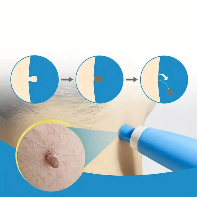 Advanced Auto Skin Tag Repair Kit DailySale