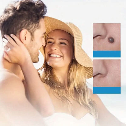 Advanced Auto Skin Tag Repair Kit DailySale