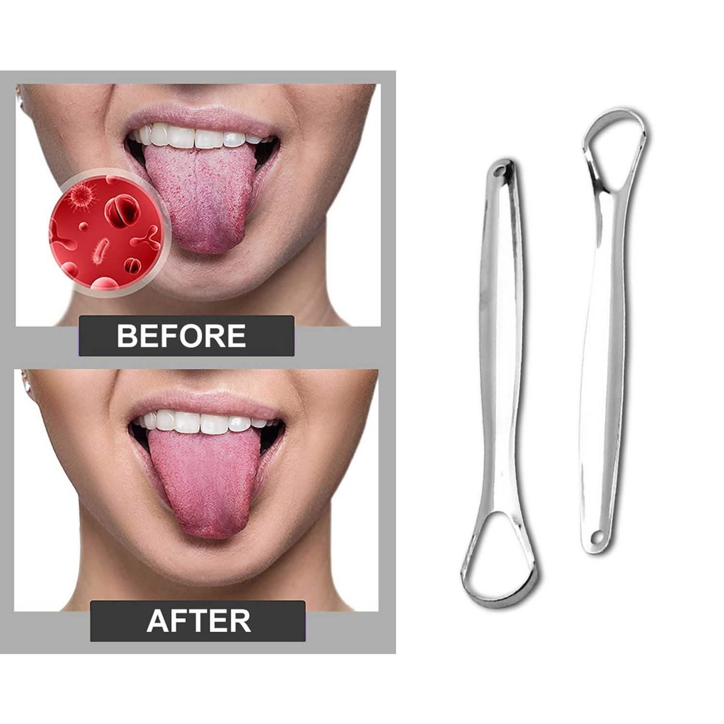2-Pack: Stainless Steel Tongue Cleaner Scraper DailySale