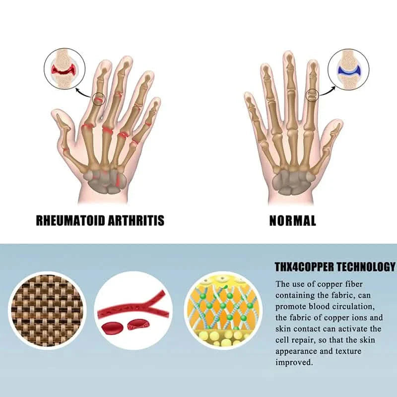 2-Pairs: Rheumatoid Arthritis Magnetic Compression Gloves DailySale