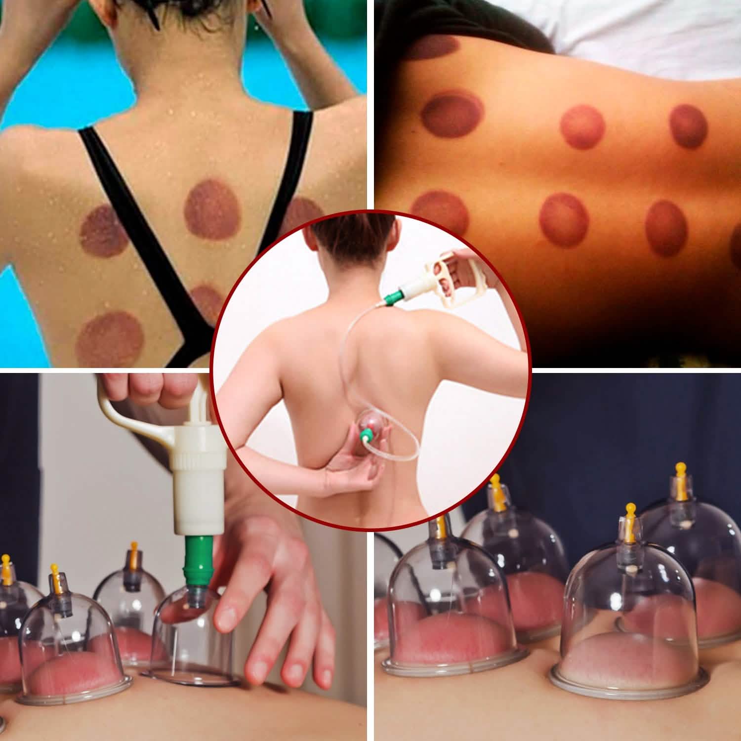 32 Cups Chinese Therapy Set DailySale