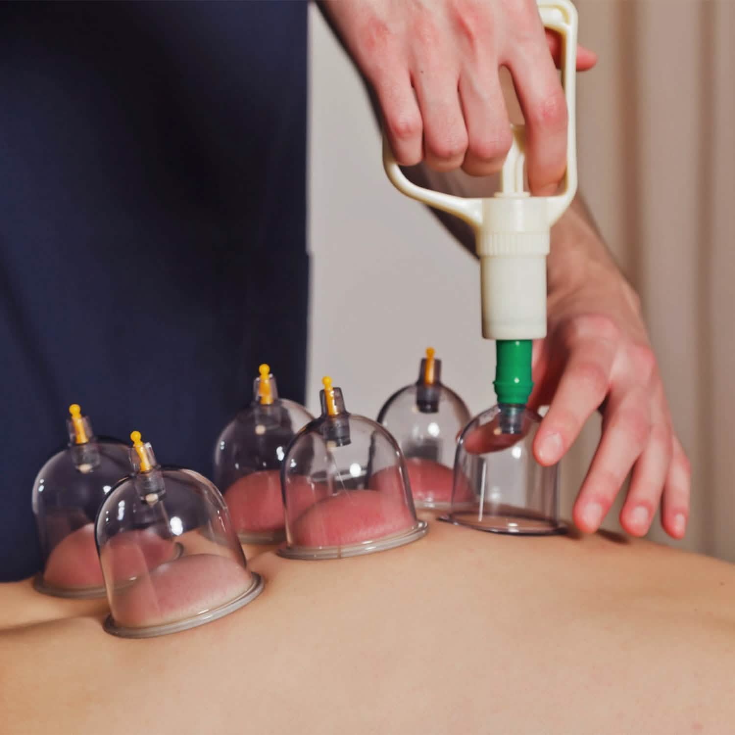 32 Cups Chinese Therapy Set DailySale