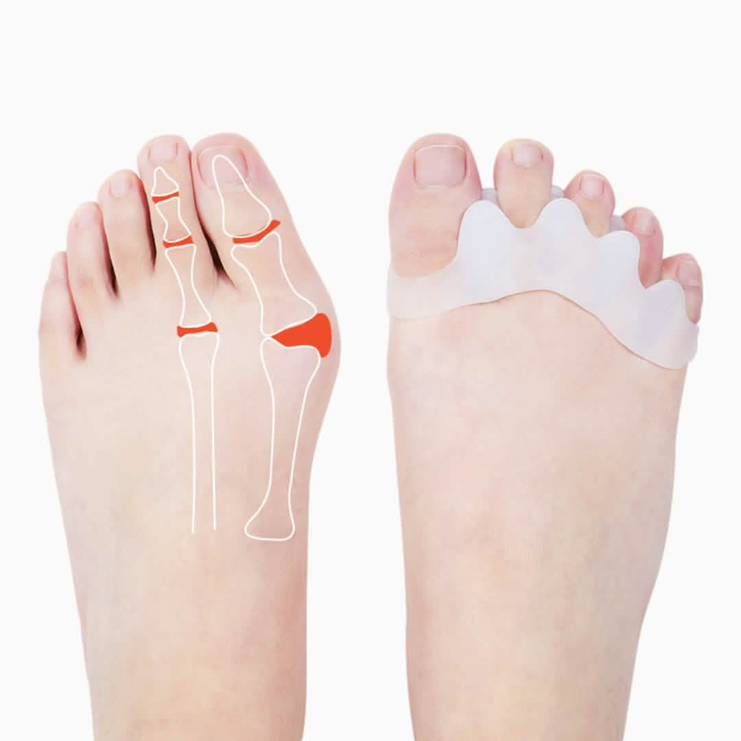 4-Pack: Toe Separator Bunion Toe Spacer for Overlapping Hammer Toe DailySale