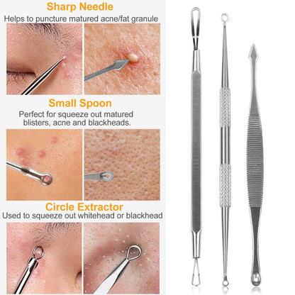 5-Piece Set: Blackhead Remover Kit Stainless Steel Popping Zit Remover DailySale