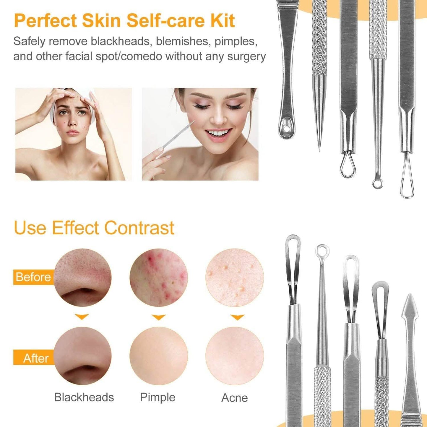 5-Pieces Set: BlackHead Remover Kit Pimple Comedone Extractor Tool Set DailySale