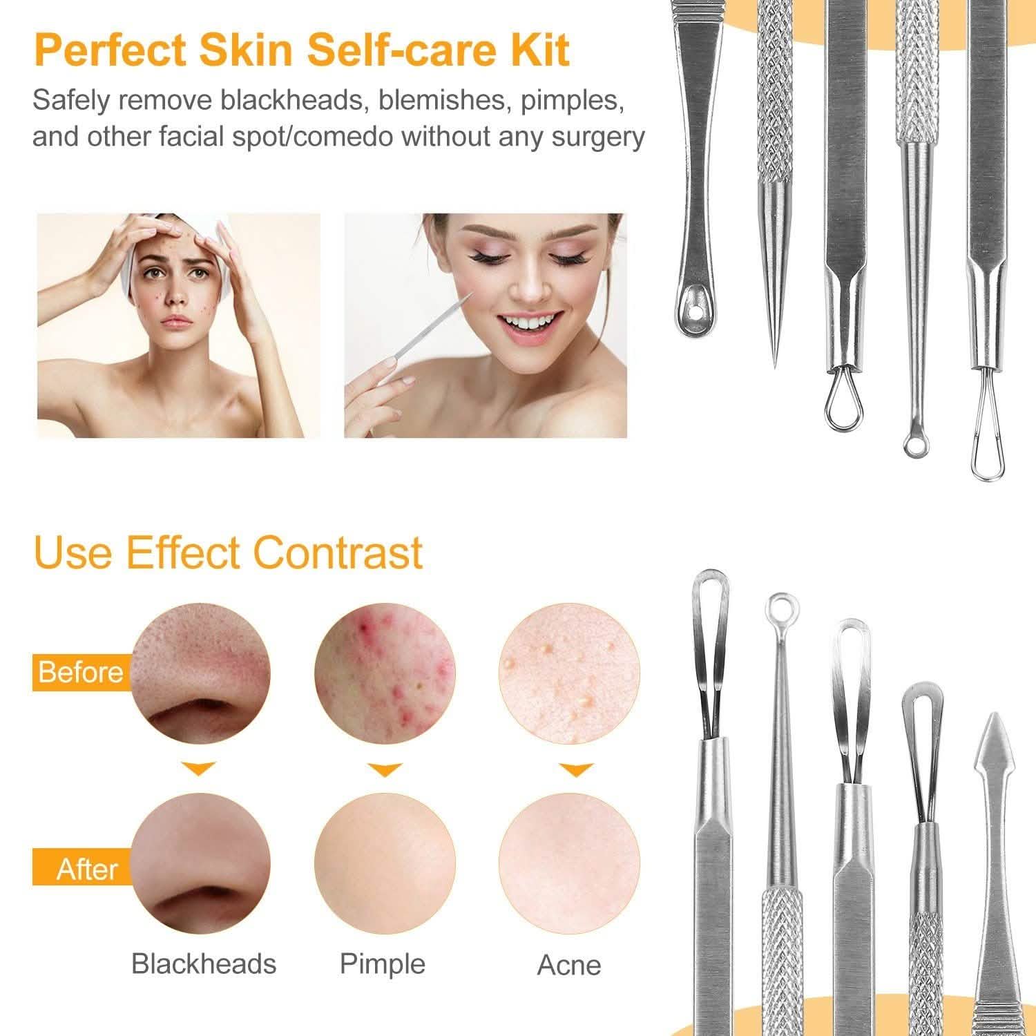 5-Pieces Set: BlackHead Remover Kit Pimple Comedone Extractor Tool Set DailySale