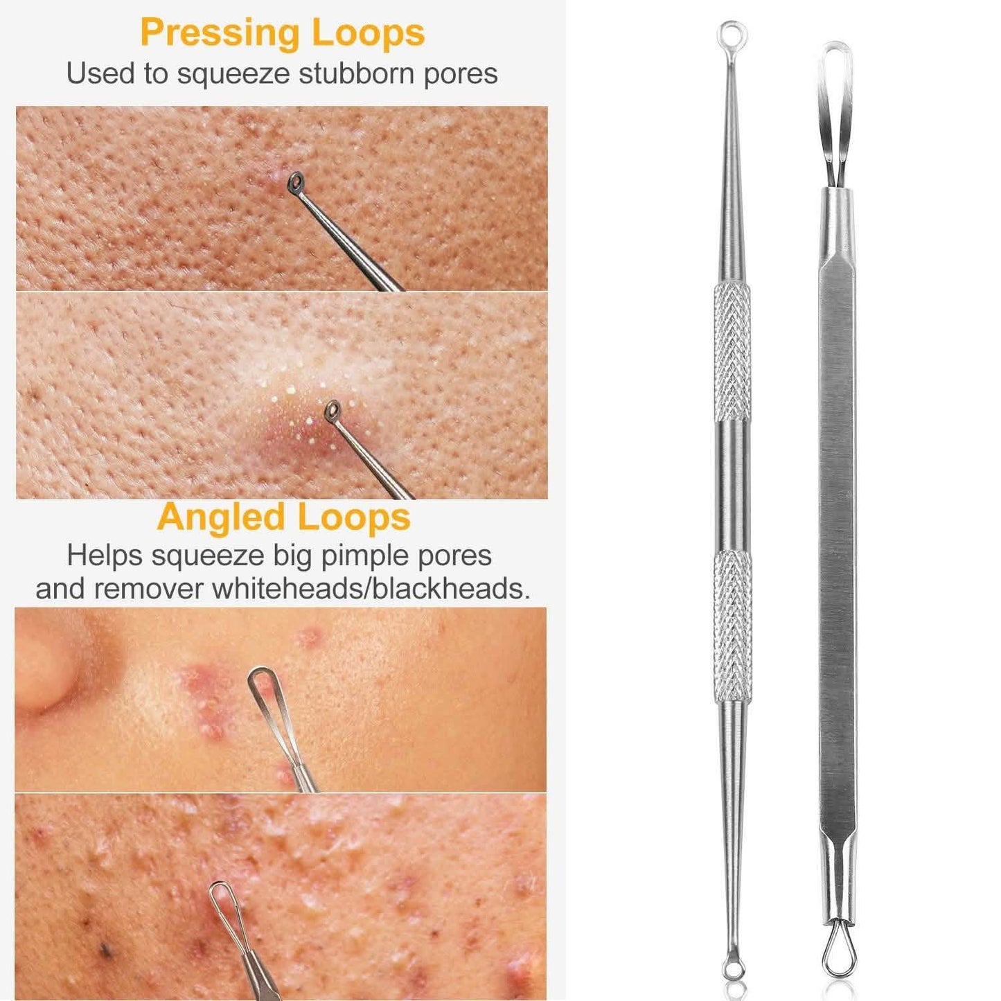 5-Pieces Set: BlackHead Remover Kit Pimple Comedone Extractor Tool Set DailySale