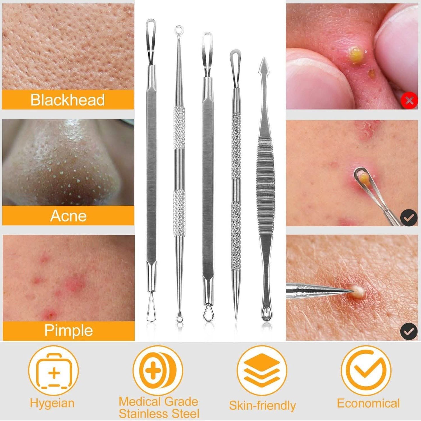 5-Pieces Set: BlackHead Remover Kit Pimple Comedone Extractor Tool Set DailySale