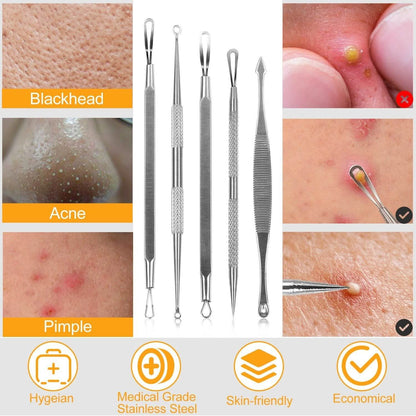 5-Pieces Set: BlackHead Remover Kit Pimple Comedone Extractor Tool Set DailySale