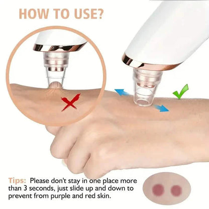 5-Suction Blackhead Removal Face Pore Cleaner DailySale