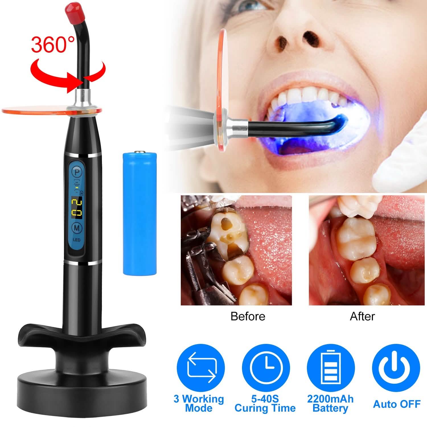 5W Cordless Dental LED Curing Light DailySale