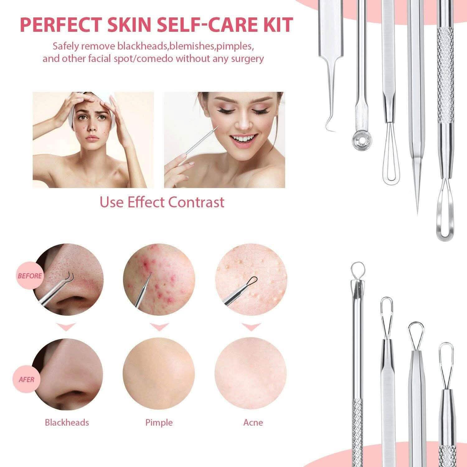6-Pieces Set: Blackhead Remover Comedones Extractor Acne Removal Kit DailySale