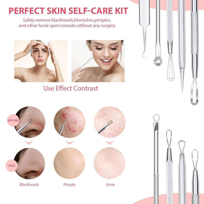 6-Pieces Set: Blackhead Remover Comedones Extractor Acne Removal Kit DailySale