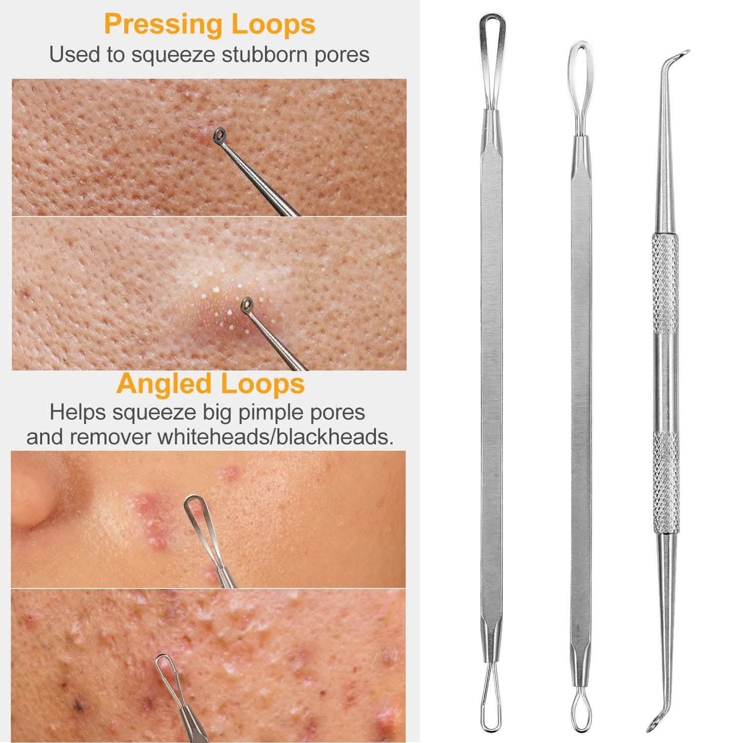 7-Pieces: Blackhead Remover Stainless Steel DailySale