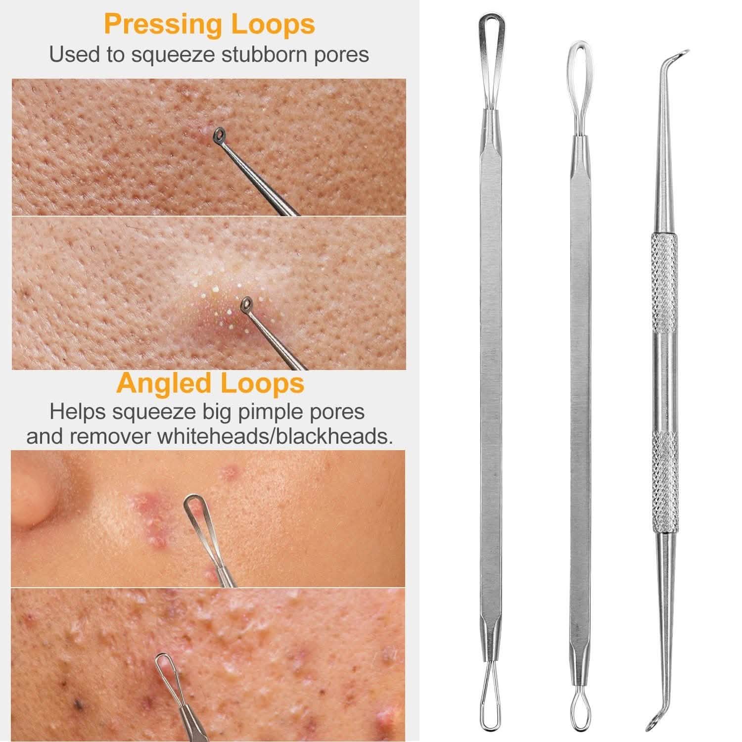 7-Pieces: Blackhead Remover Stainless Steel DailySale