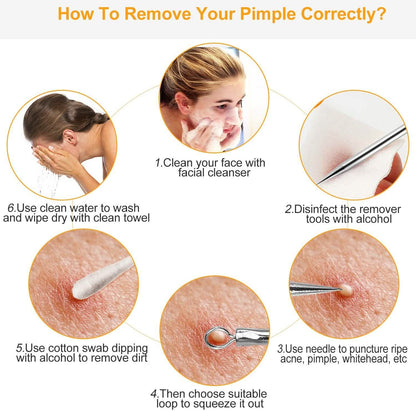 7-Pieces: Blackhead Remover Stainless Steel DailySale