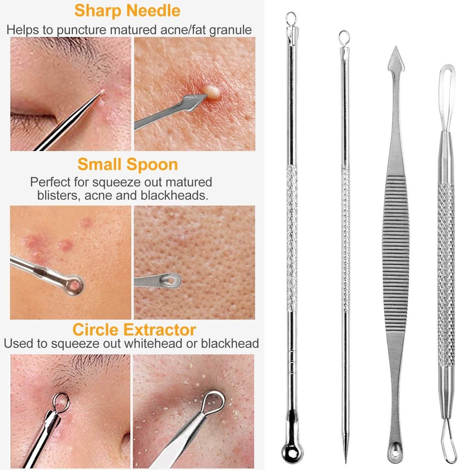7-Pieces: Blackhead Remover Stainless Steel DailySale