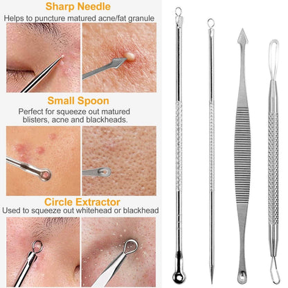 7-Pieces: Blackhead Remover Stainless Steel DailySale