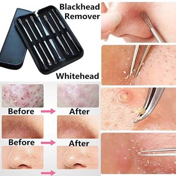 8-Pack: Professional Skin Care Kit DailySale