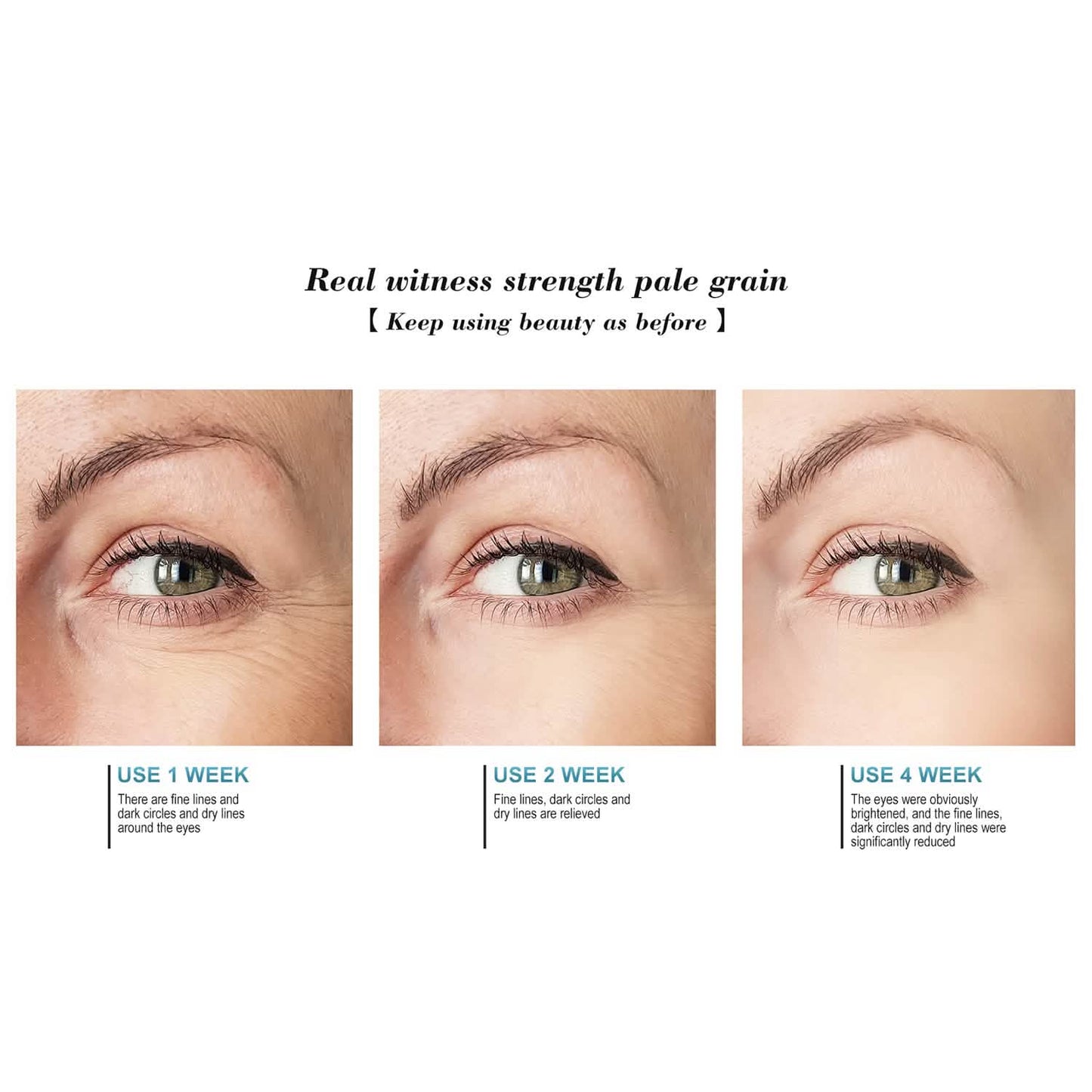 Anti-Aging Soothing Retinol Eye Cream A with Aloe, Hyaluronic Acid and Vitamin E DailySale