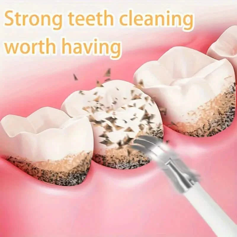 Advanced Electric Teeth Cleaning Tool Powerful Calculus Remover & Tartar Eraser DailySale