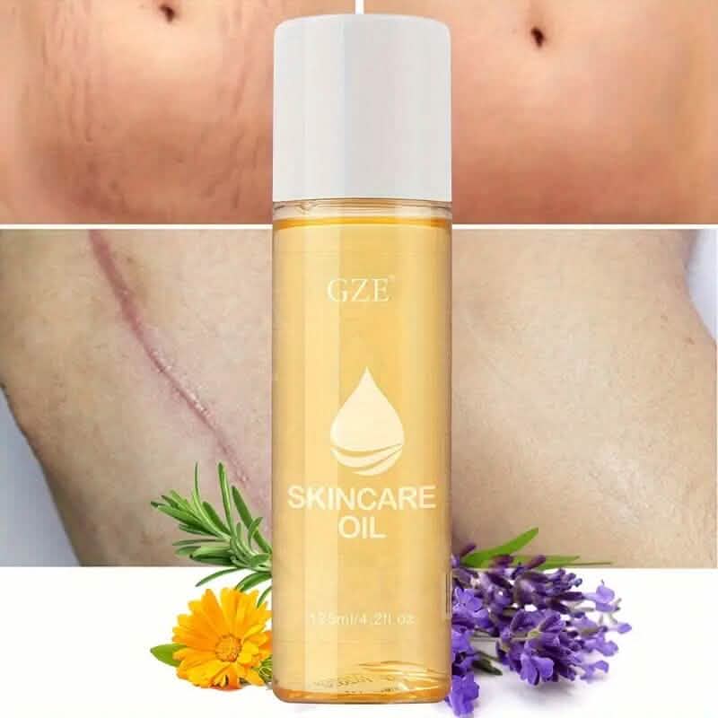 Advanced Stretch Mark Oil with Vitamin E DailySale