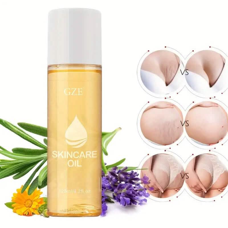 Advanced Stretch Mark Oil with Vitamin E DailySale