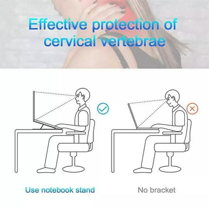 Aluminum Alloy Foldable Portable Laptop Stand DailySale