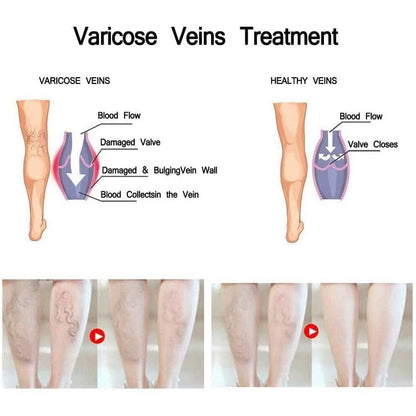 Varicose Deep Nourishing Soothing Vein Cream DailySale