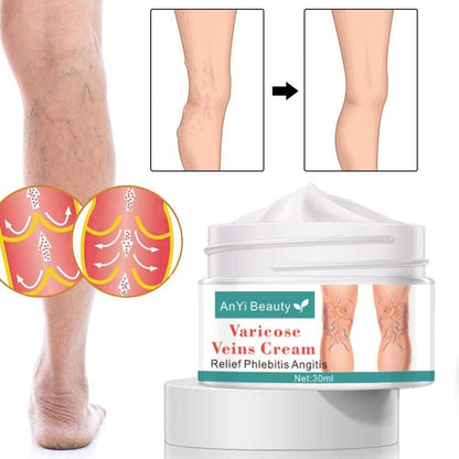 Varicose Deep Nourishing Soothing Vein Cream DailySale