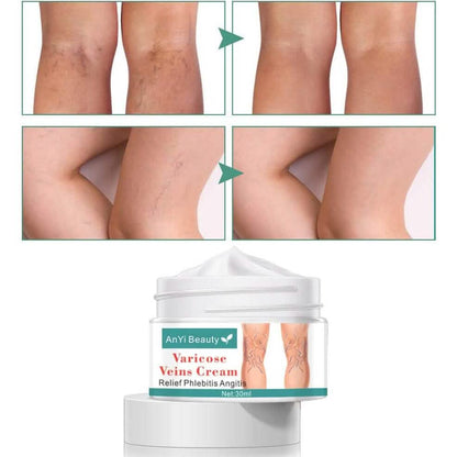 Varicose Deep Nourishing Soothing Vein Cream DailySale