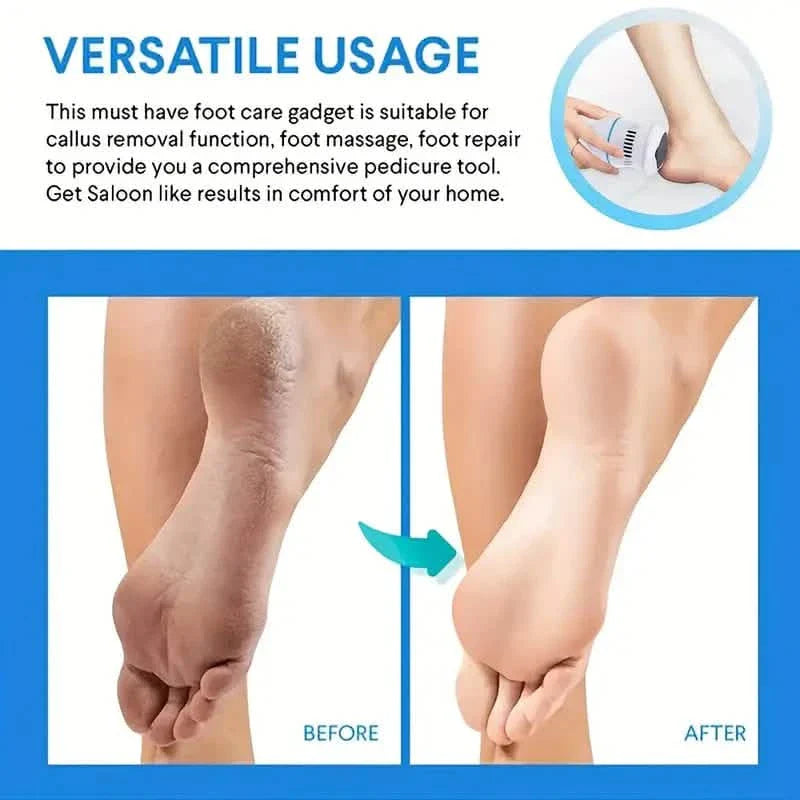 Automatic Vacuum Cleaner and Foot Grinder DailySale
