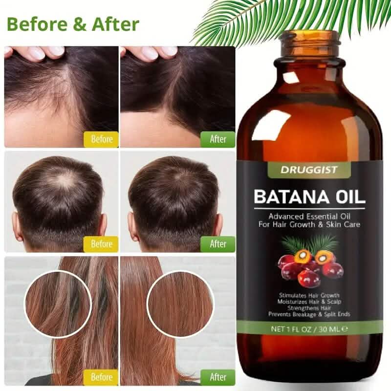 Batana Oil for Hair Growth with Argan Oil DailySale
