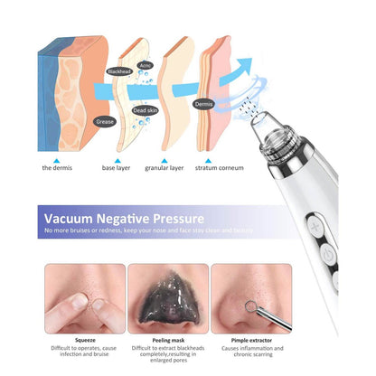 Blackhead Pore Vacuum Cleaner Remover DailySale