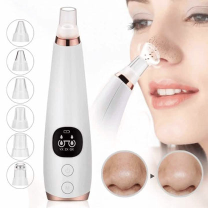 Blackhead Sucker DailySale