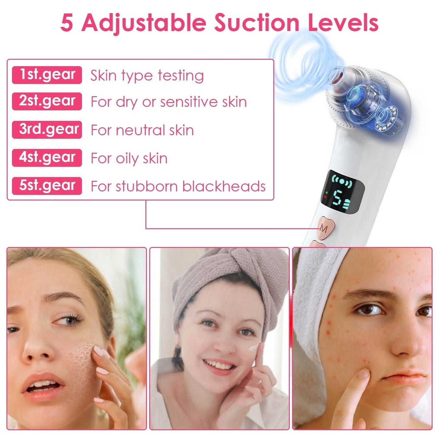 Blackhead Vacuum Remover Electric Blackhead Comedone Extractor DailySale