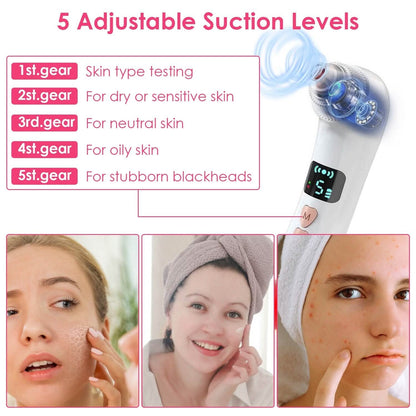 Blackhead Vacuum Remover Electric Blackhead Comedone Extractor DailySale