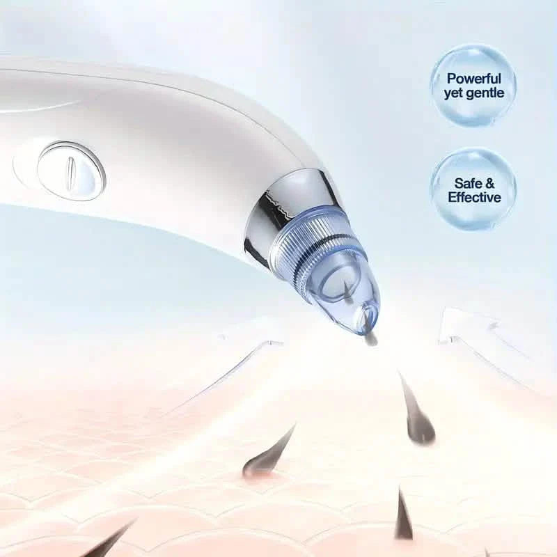 Blackhead Vacuum Remover, Powerful Portable Facial Pore Cleaner With 4 Probes DailySale