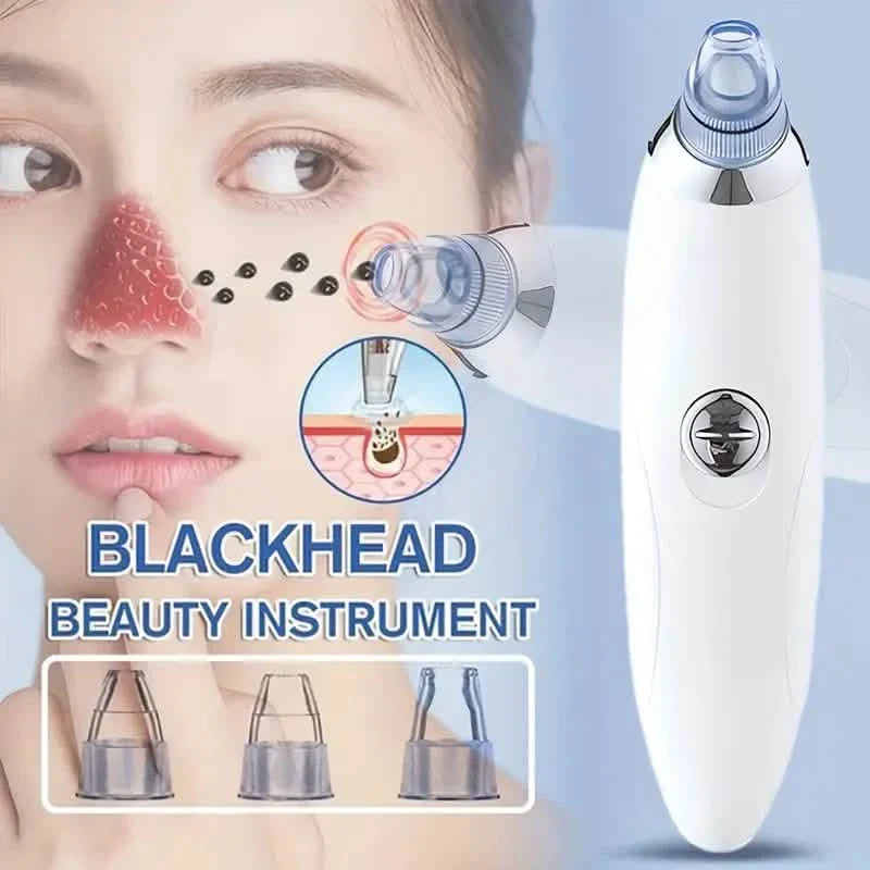 Blackhead Vacuum Remover, Powerful Portable Facial Pore Cleaner With 4 Probes DailySale