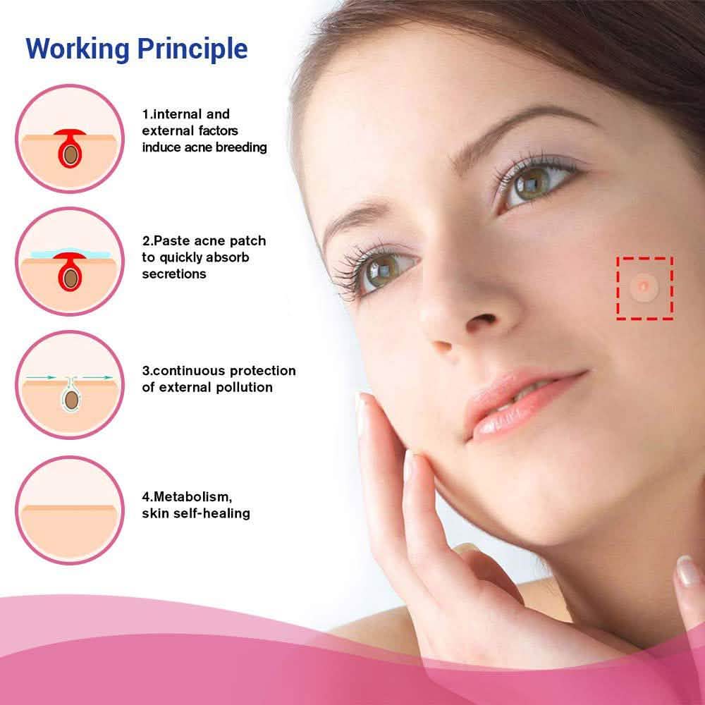 Blemish and Acne Treatment Skin Healing Spot Patches DailySale