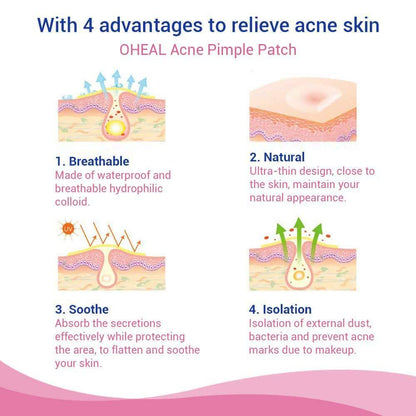 Blemish and Acne Treatment Skin Healing Spot Patches DailySale