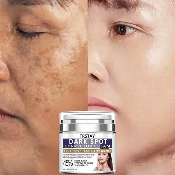 Dark Spot Corrector Cream Eliminates Dark Spots, Fades Dark Spots DailySale