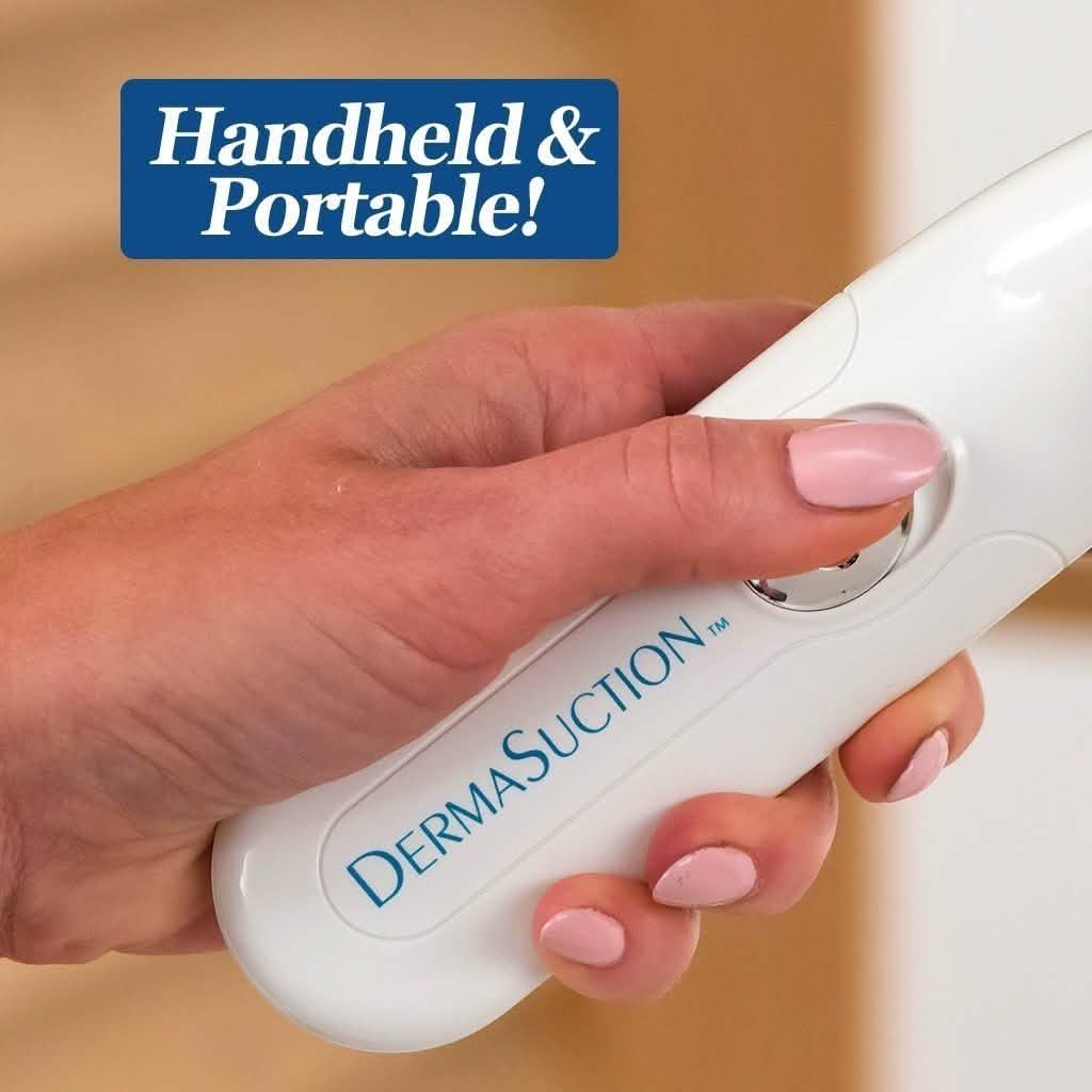 DermaSuction Blackhead Remover DailySale