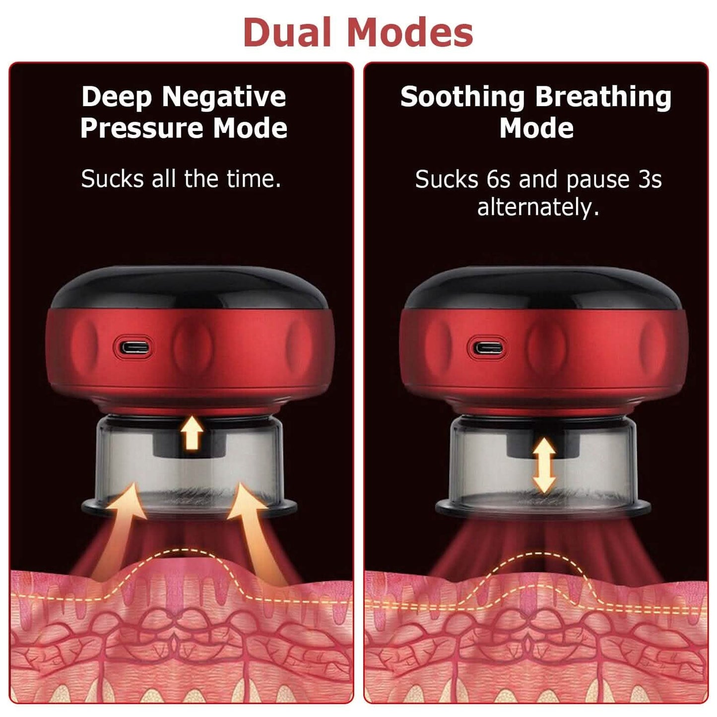 Electric Back Scraping Machine Vacuum Therapy Cupping Device DailySale