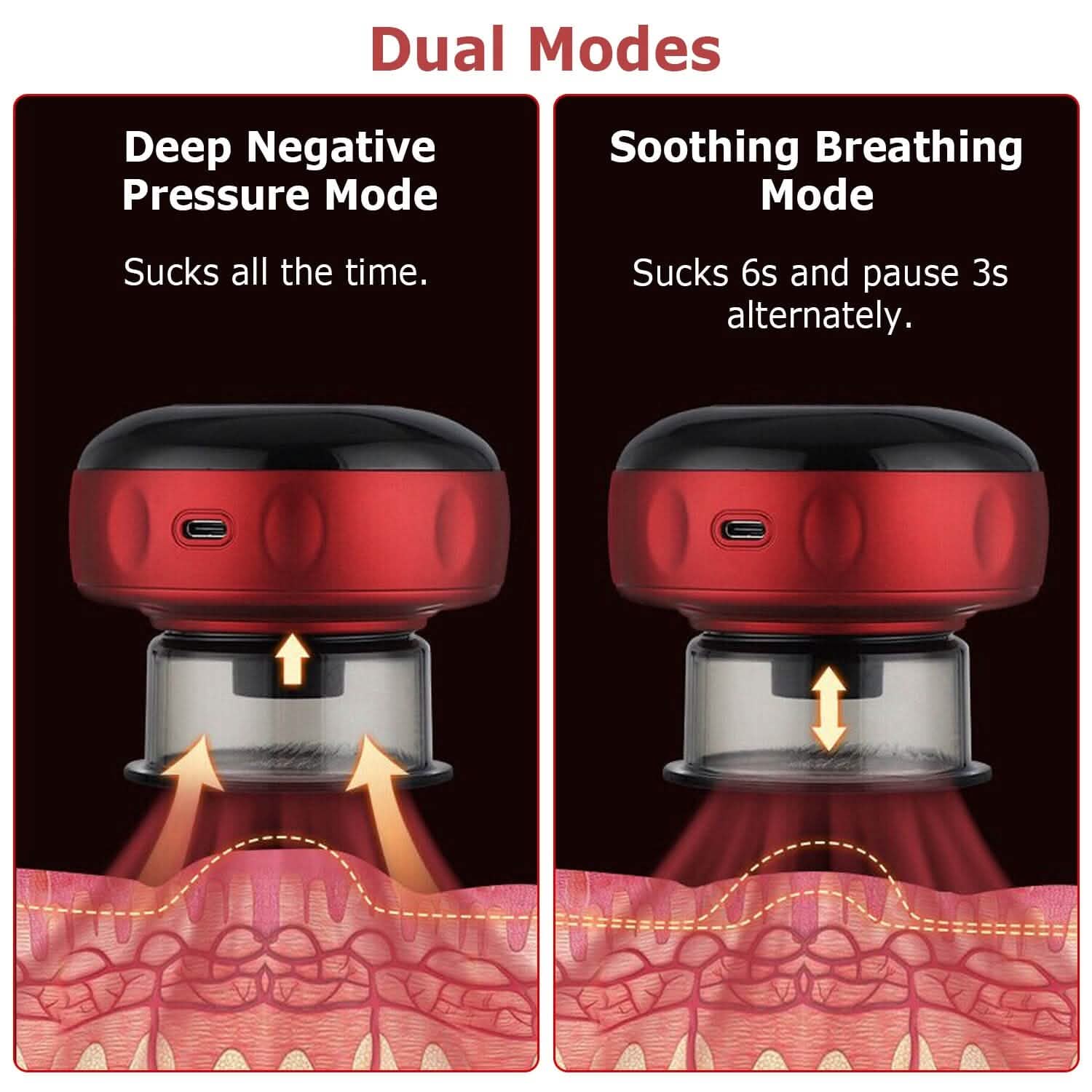 Electric Back Scraping Machine Vacuum Therapy Cupping Device DailySale