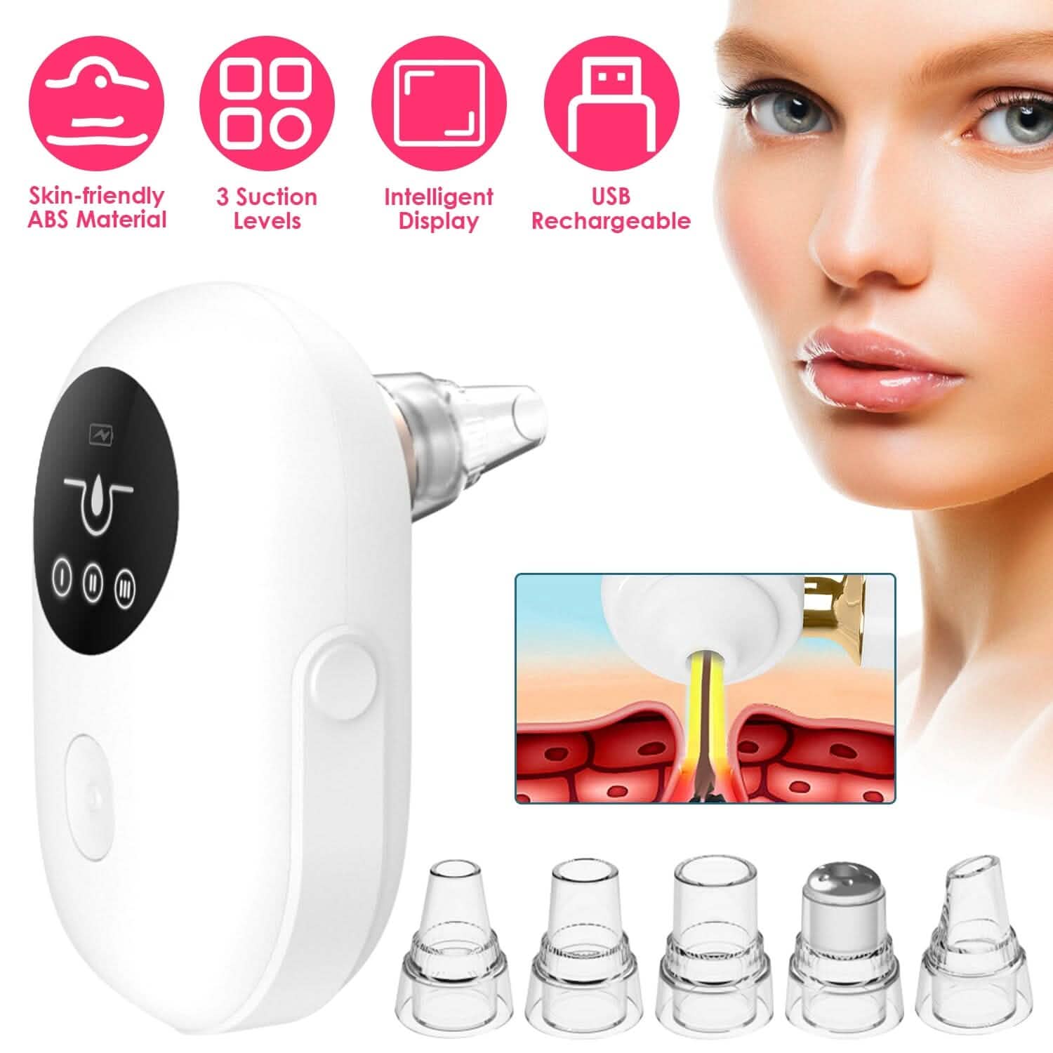 Electric Blackhead Comedone Extractor Tool Facial Pore Cleaner DailySale